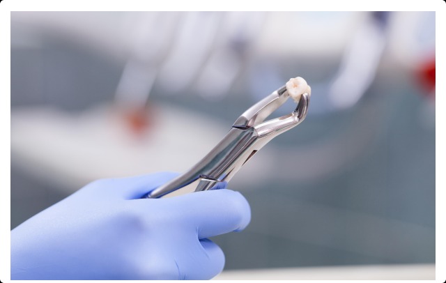Dental Implants Melbourne